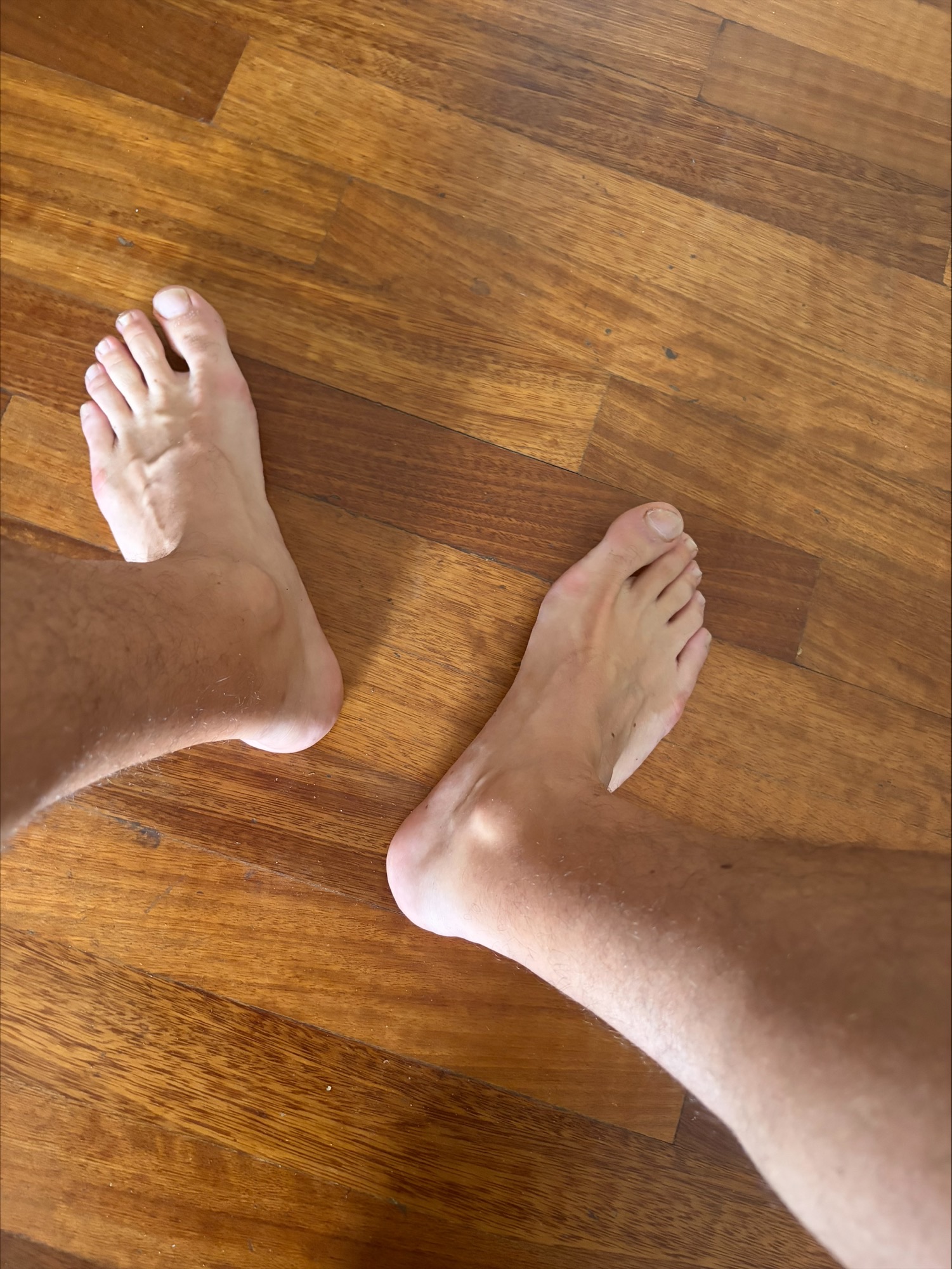 The First Step &mdash; photograph 1 in the owner's feet collection