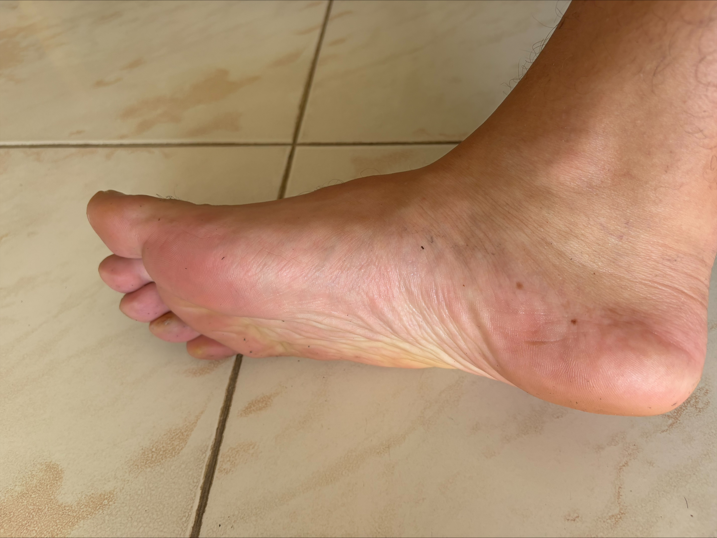 The Left Ascension &mdash; photograph 3 in the owner's feet collection